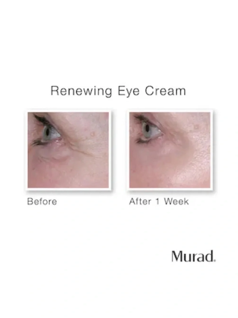 Murad Resurgence Renewing Eye Cream .5 Ounces